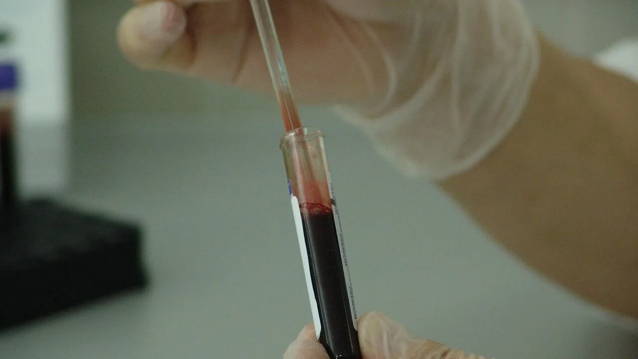Pipettes Worth Buying for Every Lab and Budget