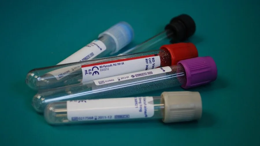 Healthcare professional examining clinical documentation and test results at desk