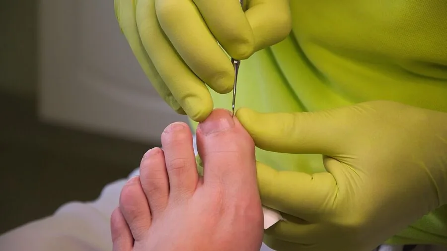 Person applying moisturizing treatment to feet during self-care routine at home