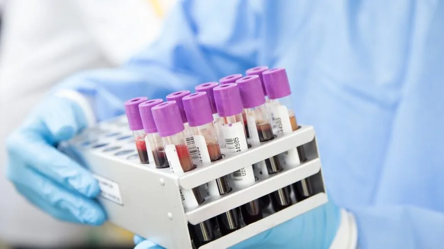Researcher arranging multiple test tubes in a laboratory workspace for an experiment