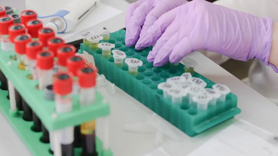 Scientist in lab coat conducting experiment with laboratory equipment and glassware