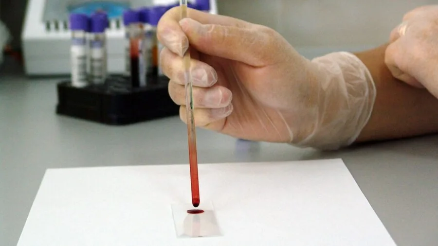 Scientist in lab coat examining liquid sample with focused attention, demonstrating precision measurement work