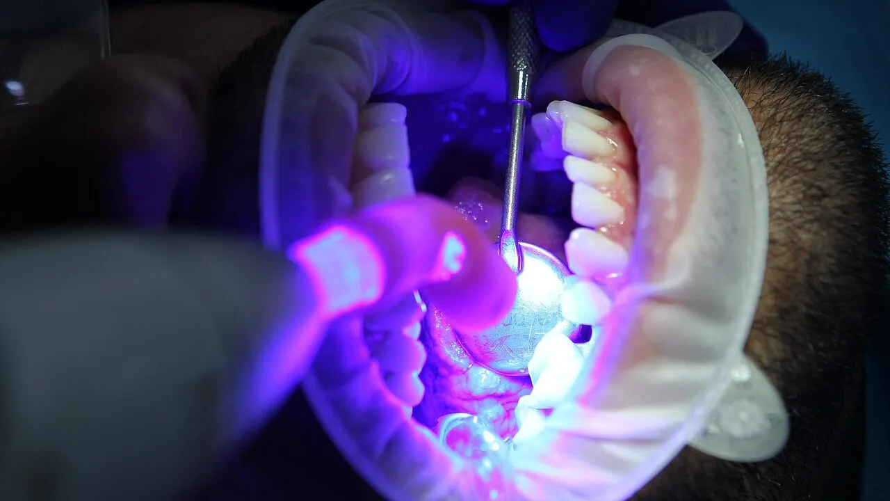 The Best Teeth Whitening Kits for Every Budget and Sensitivity Level